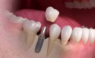 dental esthetics courses cancun CUTE SMILE Dental Care